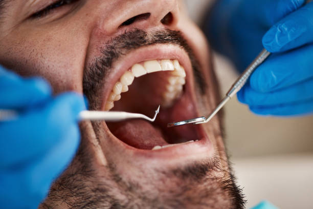 Best Emergency Dental Care for Broken or Chipped Teeth in Franklin, LA